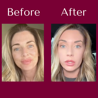 Elora NAD+ Supplement for Women